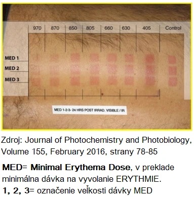 Badanie pokazujące wzrost tolerancji skóry na UV dzięki światłu czerwonemu